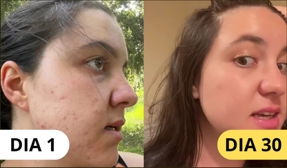 Bálsamo de sebo todo en uno